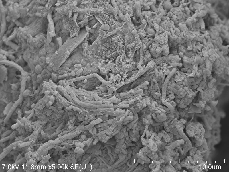 Mikrografie ze skaningowego mikroskopu elektronowego (SEM) świeżego osadu czynnego (bogactwo mikroorganizmów, które w oczyszczalniach ścieków odpowiada za biologiczną degradację zanieczyszczeń w ściekach) pobranego z oczyszczalni ścieków Klimzowiec, z której dr Anna Dzionek izolowała bakterie zdolne do biodegradacji beta-blokerów.