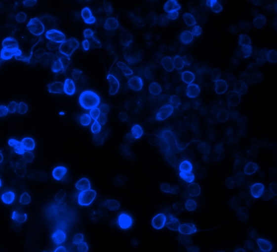 Komórki nowotworu jelita grubego potraktowane pochodnymi chinoliny i obserwowane pod mikroskopem fluorescencyjnym