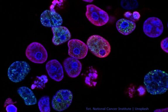 Komórki nowotworowe widziane pod mikroskopem