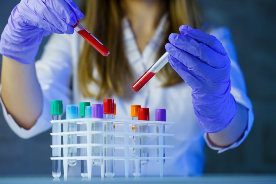 dziewczyna pracuje z próbówkami laboratoryjnymi