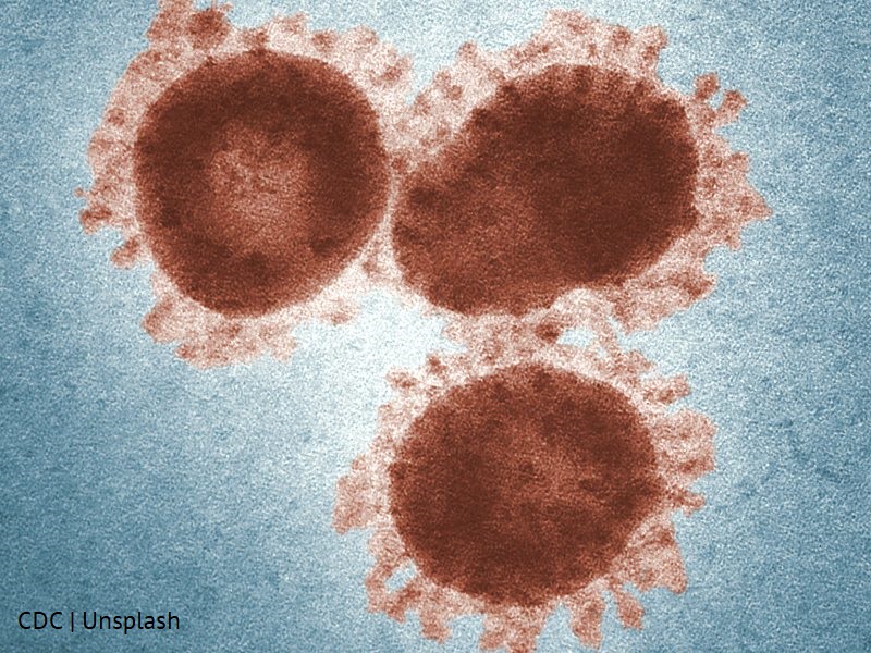 Zdjęcie wirusów spod mikroskopu elektronowego, kolorowane